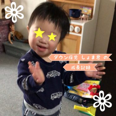 ダウン症の首すわりはいつから むくみやだぶつきがある理由 It S Show Down