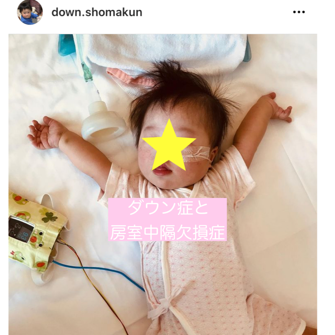 房室中隔欠損症の手術と入院中のお話し ダウン症のしょま君 It S Show Down
