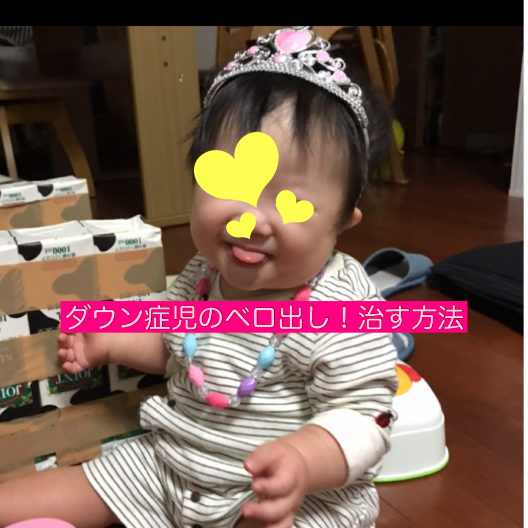 ダウン症のベロ出しを治す方法はある なぜ出るのか理由も解説 It S Show Down